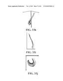 Scoring Method for Imaging-Based Detection of Vulnerable Patients diagram and image