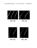 Scoring Method for Imaging-Based Detection of Vulnerable Patients diagram and image