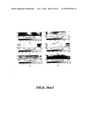 Scoring Method for Imaging-Based Detection of Vulnerable Patients diagram and image