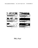 Scoring Method for Imaging-Based Detection of Vulnerable Patients diagram and image