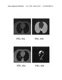 Scoring Method for Imaging-Based Detection of Vulnerable Patients diagram and image