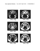 Scoring Method for Imaging-Based Detection of Vulnerable Patients diagram and image