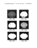 Scoring Method for Imaging-Based Detection of Vulnerable Patients diagram and image