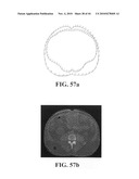 Scoring Method for Imaging-Based Detection of Vulnerable Patients diagram and image