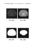 Scoring Method for Imaging-Based Detection of Vulnerable Patients diagram and image