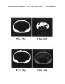 Scoring Method for Imaging-Based Detection of Vulnerable Patients diagram and image