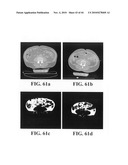 Scoring Method for Imaging-Based Detection of Vulnerable Patients diagram and image