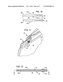 Flexible fluid container with removable slide fastener diagram and image