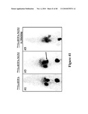 Mechanism-Based Targeted Pancreatic Beta Cell Imaging and Therapy diagram and image