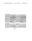 METHODS FOR TREATMENT AND PREVENTION OF TAUOPATHIES AND AMYLOID BETA AMYLOIDOSIS BY MODULATING CRF RECEPTOR SIGNALING diagram and image