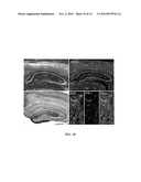 METHODS FOR TREATMENT AND PREVENTION OF TAUOPATHIES AND AMYLOID BETA AMYLOIDOSIS BY MODULATING CRF RECEPTOR SIGNALING diagram and image