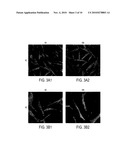 Alzheimer s Disease Diagnosis Based on Mitogen-Activated Protein Kinase Phosphorylation diagram and image