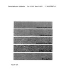 COMPOUNDS AND METHODS FOR THE TREATMENT OF RENAL DISEASE diagram and image