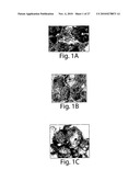 STIMULATION OF ANTI-TUMOR IMMUNITY USING DENDRITIC CELL/TUMOR CELL FUSIONS AND ANTI-CD3/CD28 diagram and image