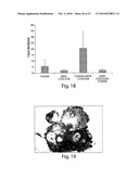 STIMULATION OF ANTI-TUMOR IMMUNITY USING DENDRITIC CELL/TUMOR CELL FUSIONS AND ANTI-CD3/CD28 diagram and image