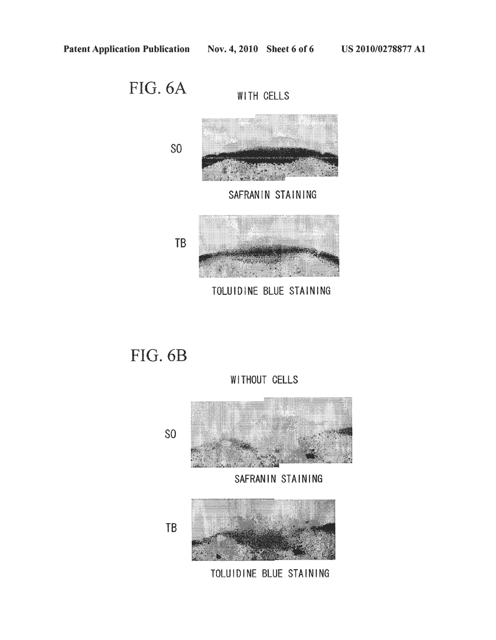 BODY TISSUE FILLING MATERIAL AND METHOD FOR PRODUCTION THEREOF - diagram, schematic, and image 07