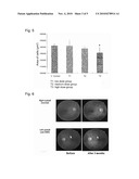 FRACTION OF MELISSA LEAF EXTRACT HAVING ANGIOGENESIS AND MMP INHIBITORY ACTIVITIES, AND COMPOSITION COMPRISING THE SAME diagram and image