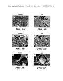 SILK FIBROIN MATERIALS AND USE THEREOF diagram and image