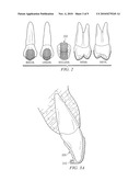 Removable Orthodontic Appliance and Method of Forming the Same diagram and image