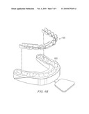 Removable Orthodontic Appliance and Method of Forming the Same diagram and image