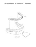 Removable Orthodontic Appliance and Method of Forming the Same diagram and image