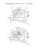 Self-ligating orthodontic bracket diagram and image