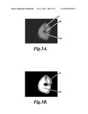 DEVICE AND METHOD FOR PREDICTING THE LIKELIHOOD OF CARIES DEVELOPMENT diagram and image