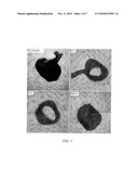 Angiogenesis Inhibiting Molecules, Their Selection, Production and Their Use in the Treatment of Cancer diagram and image