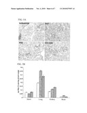 Angiogenesis Inhibiting Molecules, Their Selection, Production and Their Use in the Treatment of Cancer diagram and image