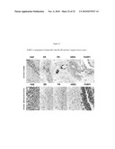 METHOD OF TREATING DISEASES WITH PARP INHIBITORS diagram and image