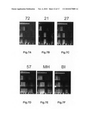 Population scale HLA-typing and uses thereof diagram and image