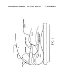 ENDOSCOPIC MESH DELIVERY SYSTEM WITH INTEGRAL MESH STABILIZER AND VAGINAL PROBE diagram and image