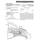 OCULAR IMPLANT DELIVERY SYSTEMS AND METHODS diagram and image