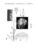 OCULAR IMPLANT DELIVERY SYSTEMS AND METHODS diagram and image