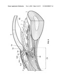 OCULAR IMPLANT DELIVERY SYSTEMS AND METHODS diagram and image