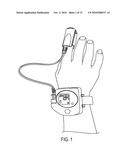 SIMULTANEOUS AMBULATORY PULSE OXIMETRY AND PH MONITORING FOR THE DIAGNOSIS OF GERD-RELATED RESPIRATORY DISEASE diagram and image