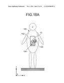 MEDICAL SYSTEM AND METHOD OF SWITCHING ANTENNA diagram and image