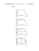 APPARATUS AND METHOD FOR ASSESSING ROTATIONAL BONE KINEMATICS diagram and image