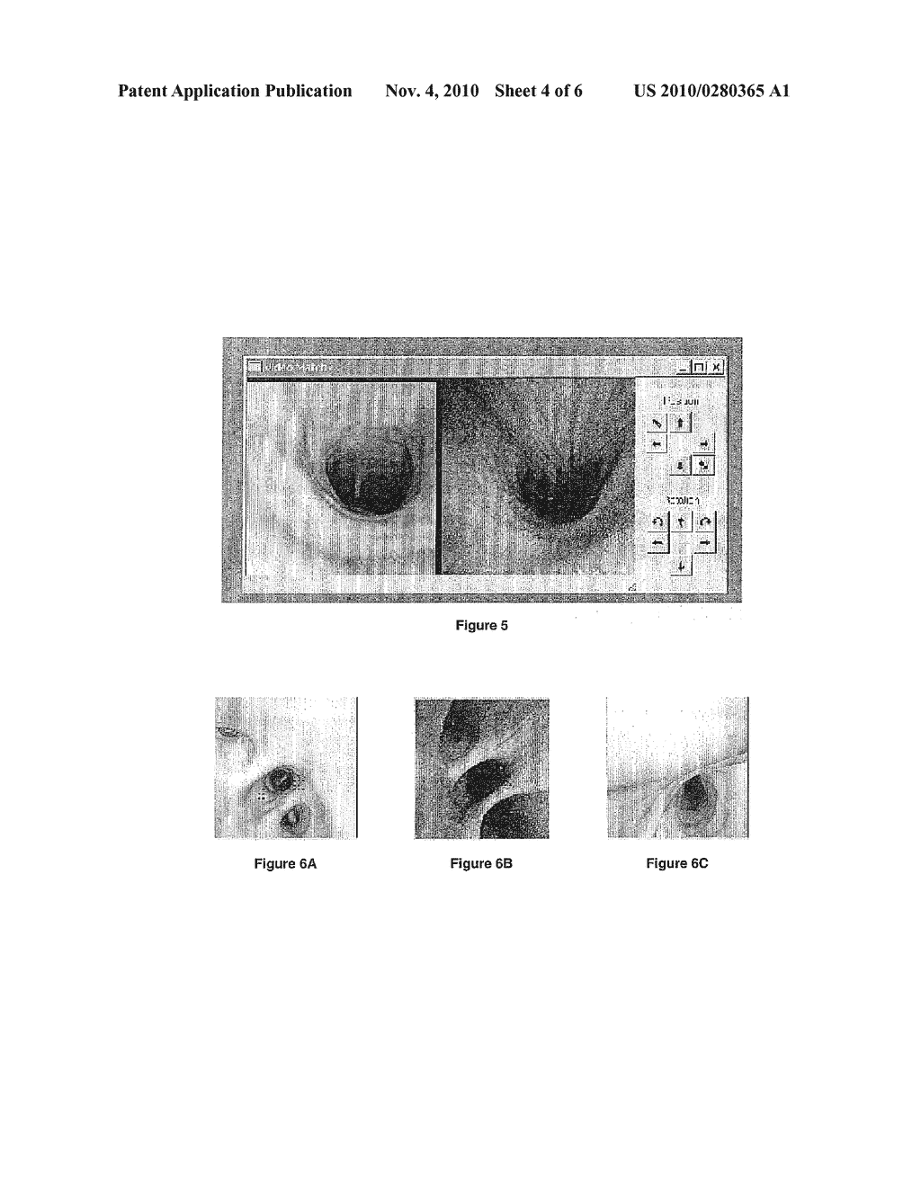 GUIDANCE METHOD BASED ON 3D-2D POSE ESTIMATION AND 3D-CT REGISTRATION WITH APPLICATION TO LIVE BRONCHOSCOPY - diagram, schematic, and image 05