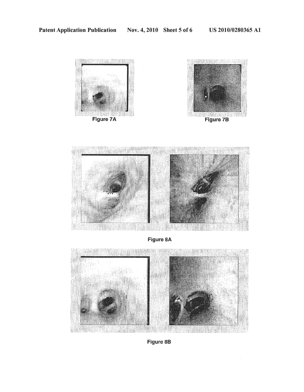 GUIDANCE METHOD BASED ON 3D-2D POSE ESTIMATION AND 3D-CT REGISTRATION WITH APPLICATION TO LIVE BRONCHOSCOPY - diagram, schematic, and image 06