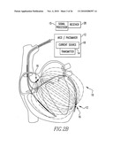 Method and apparatus for monitoring an organ of a patient diagram and image