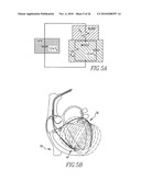 Method and apparatus for monitoring an organ of a patient diagram and image