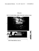 LASER DOPPLER BLOOD FLOW MEASURING METHOD AND DEVICE diagram and image