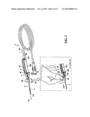 NEEDLE-STENT DEVICE diagram and image