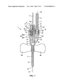 NEEDLE-STENT DEVICE diagram and image