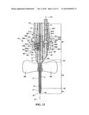 NEEDLE-STENT DEVICE diagram and image