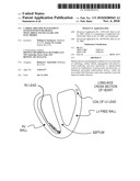 CARDIAC RHYTHM MANAGEMENT SYSTEM WITH INTRAMURAL MYOCARDIAL PACING LEADS AND ELECTRODES diagram and image