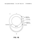 CARDIAC RHYTHM MANAGEMENT SYSTEM WITH INTRAMURAL MYOCARDIAL PACING LEADS AND ELECTRODES diagram and image