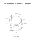 CARDIAC RHYTHM MANAGEMENT SYSTEM WITH INTRAMURAL MYOCARDIAL PACING LEADS AND ELECTRODES diagram and image