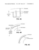 CARDIAC RHYTHM MANAGEMENT SYSTEM WITH INTRAMURAL MYOCARDIAL PACING LEADS AND ELECTRODES diagram and image